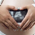 Как часто можно делать узи при беременности